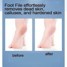 Foot File Foot Callus Remover, Double Sided Pedicure Tools for Feet Dead Skin, Dual Use of Dry and Wet, Professional Hygienic Foot Scrubber to Achieve Smooth, Silky Feet - Accessories suitable for foot soaking massager buckets (yellow)