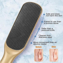 Foot File Foot Callus Remover, Double Sided Pedicure Tools for Feet Dead Skin, Dual Use of Dry and Wet, Professional Hygienic Foot Scrubber to Achieve Smooth, Silky Feet - Accessories suitable for foot soaking massager buckets (golden)